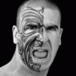 Ranoldvor